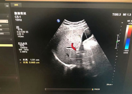 Sonde ad ultrasuoni mediche addominali Philip C5-1 Per dispositivo EPIQ 5